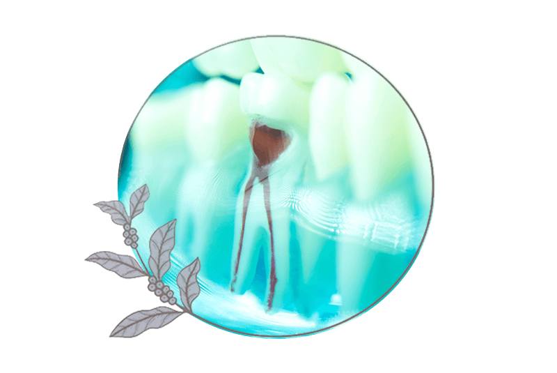 close up of root canal