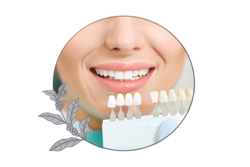 close up of person having their teeth being compared for a teeth whitening procedure