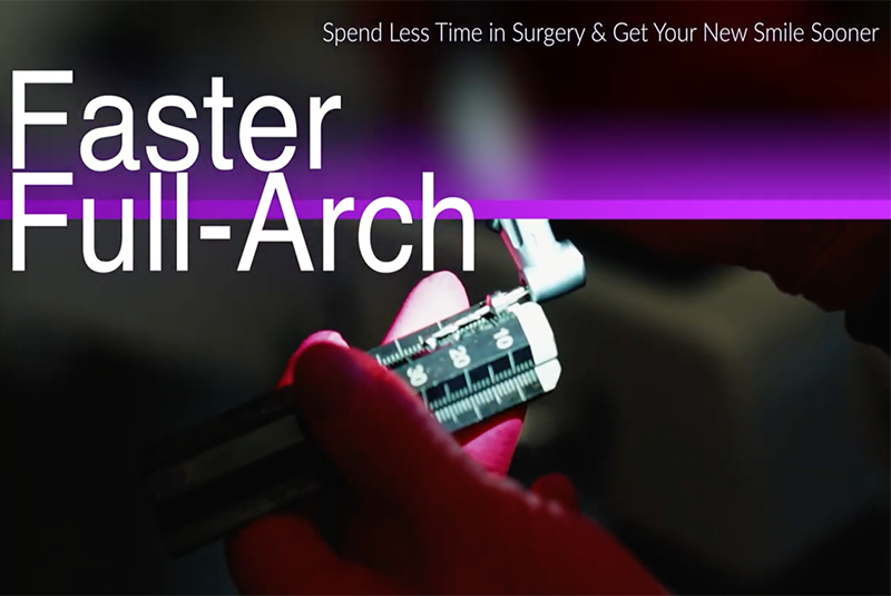 Faster full-arch Yomi robotic implant surgery video thumbnail